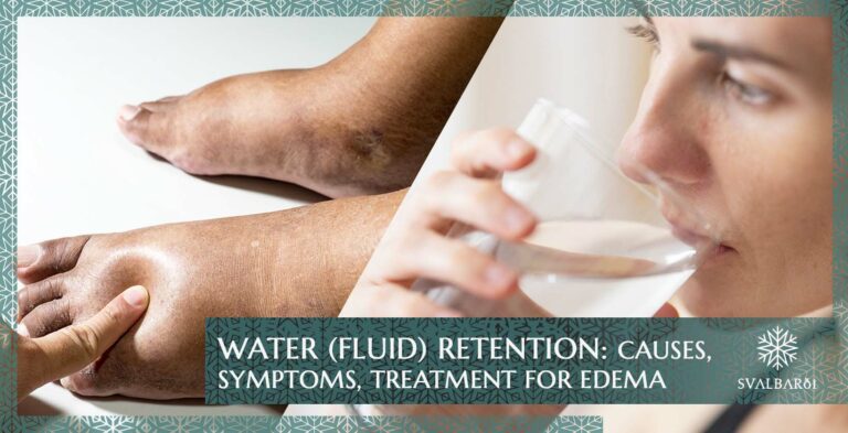 Wasser (Flüssigkeit) Retention: Ursachen, Symptome, Behandlung von Ödemen